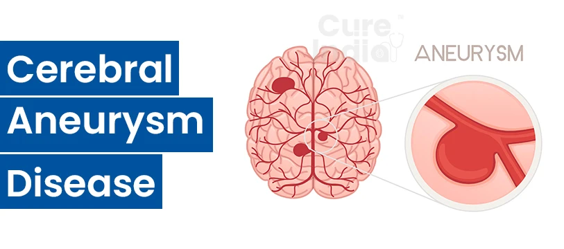 What is a Cerebral Aneurysm